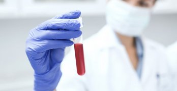 Cum de a închiria un test de sânge comun