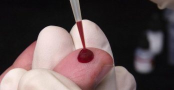 Cum de a închiria un test de sânge comun