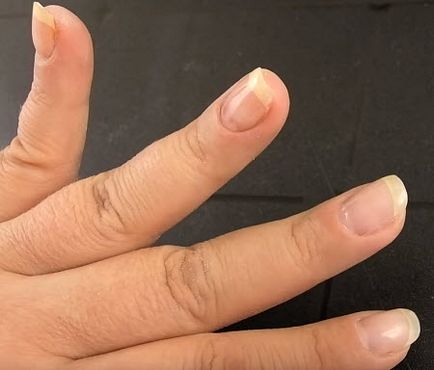 Cum de a elimina unghiile cu gel Naroscheny