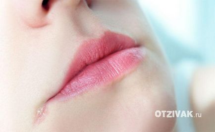 De ce buzele crăpate colțuri și cum să le trateze