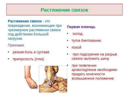 Pentru tratamentul rupturile de ligament