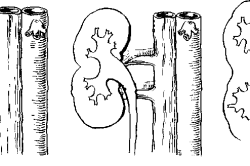 Care este dublarea parțială a rinichilor