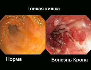 Mucusul din anus ea