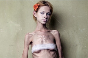 Tratamentul anorexie la domiciliu - 15 rețete!