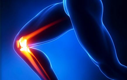 Osteoartrita a genunchiului