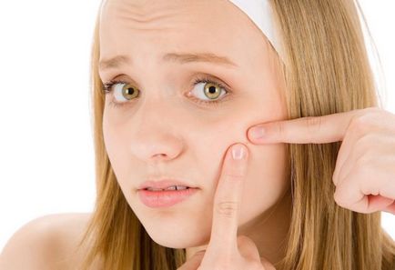 Cum de a accelera maturizarea acnee decât răspândirea, cum să se înțeleagă că acnee este copt
