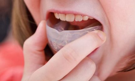 Cum să se alinieze dintii fara bretele care pot fi folosite la domiciliu