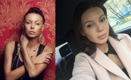 Oksana Samoilova înainte și după plastic - 300