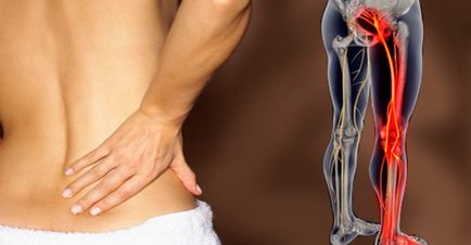 Complicațiile după accident vascular cerebral precoce și tardive (prevenirea escare) Complicațiile după accident vascular cerebral precoce și tardivă
