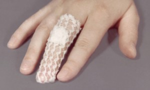 degetele de la mâini și picioare Felon - cât de repede se vindeca inflamatie si prevenirea complicatiilor