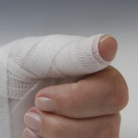 Primul ajutor pentru un deget tăiat ca o opri rapid sânge decât pentru a trata o tăietură adâncă