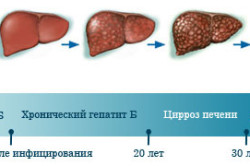 Vaccinarea împotriva difteriei