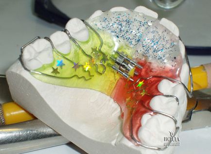 Sfaturi ortodontist