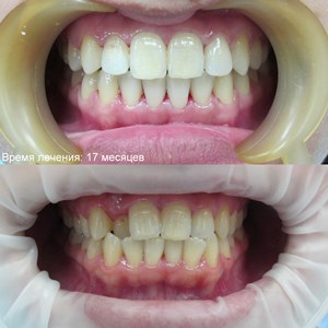 Bretele, clinica moderna stomatologie „garant“