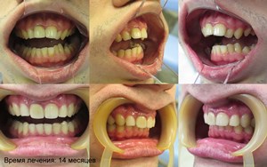 Bretele, clinica moderna stomatologie „garant“ (garant) Bretele, clinica moderna stomatologie „garant“