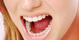 Bretele, clinica moderna stomatologie „garant“ (sistem de suport Ufa) Bretele, clinica moderna stomatologie „garant“