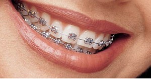 Bretele, clinica moderna stomatologie „garant“ (sistem de suport Ufa) Bretele, clinica moderna stomatologie „garant“