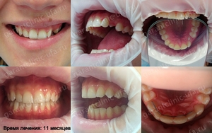 Bretele, clinica moderna stomatologie „garant“ (moderne) Bretele, clinica moderna stomatologie „garant“