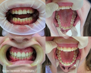 Bretele, clinica moderna stomatologie „garant“ (sistem de suport Ufa) Bretele, clinica moderna stomatologie „garant“