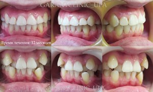 Acolade, clinica de stomatologie moderna „garante“ (edzhuays sistem Ufa) Bretele, clinica moderna stomatologie „garant“