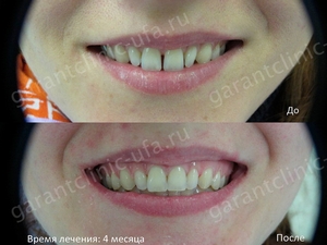Bretele, clinica moderna stomatologie „garant“ (moderne) Bretele, clinica moderna stomatologie „garant“