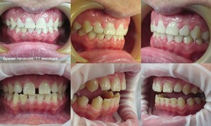 Acolade, clinica de stomatologie moderna „garante“ (edzhuays sistem Ufa) Bretele, clinica moderna stomatologie „garant“