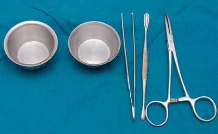 rezecție laparoscopică a ovarului ceea ce este, consecințele operațiunii, precum și indicații și contraindicații
