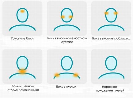 Consecințele malocluzii la adulți decât la copii amenință să ignore problema (consecințele malocluzii la adulți) Consecințele malocluzii la adulți decât la copii amenință să ignore problema