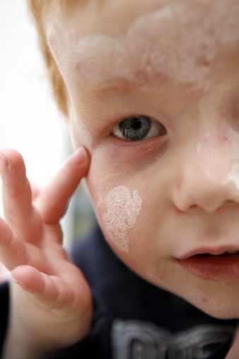 Psoriazisul la copii cauze, simptome și tratament - un ghid pentru boli de piele