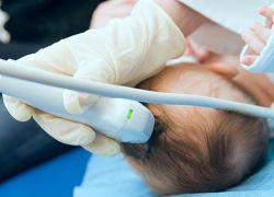 ultrasunete creier neonatală