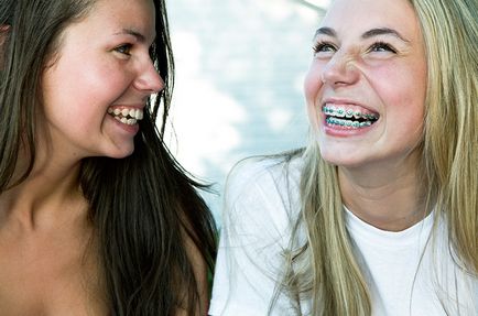 Tot ce trebuie să știți despre aparat dentar, revista cosmopolită