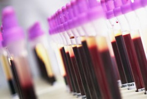 Ce ast test de sange arata ca aceasta este norma pentru femei, copii și bărbați