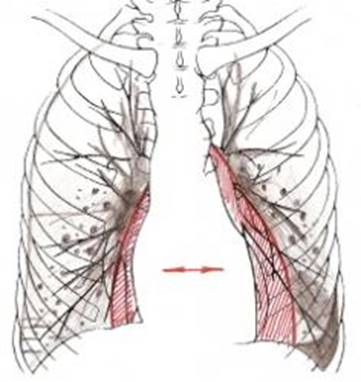 Ce este pneumonia congestiv