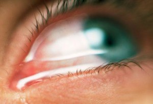 picături pentru ochi în timpul prejudiciu ochi de prim ajutor și tipurile de