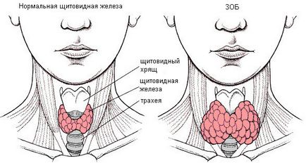 Creșterea simptome tiroidiene