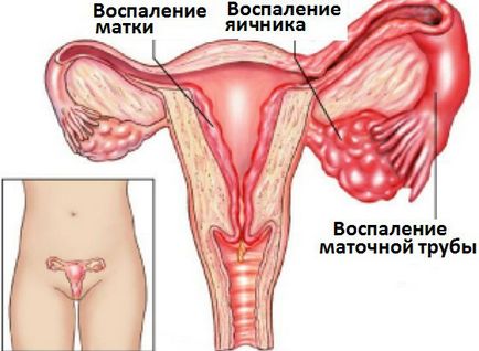 evidenția Întuneric că aceasta poate fi