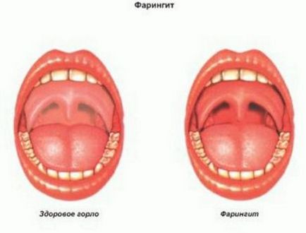 gâtul copilului de a face roșu