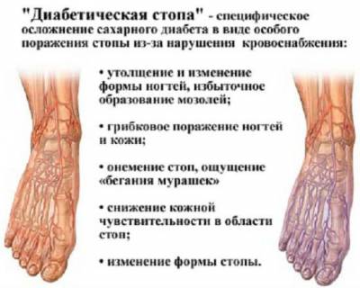 Diabetici Foot Care