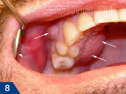 Cum de a trata dintii, sub anestezie generală