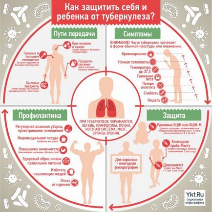 Tratamentul tuberculozei la domiciliu