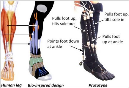 proteze bionice