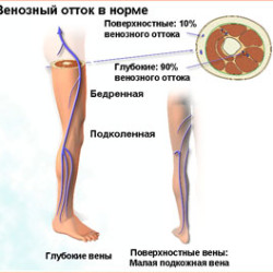 Cum de a elimina durerea la nivelul picioarelor