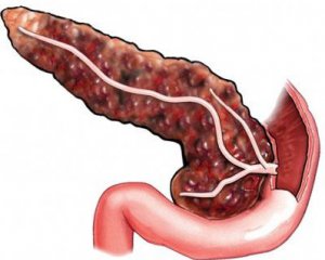 Ce este pancreatita pancreasului