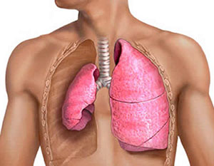 Pleurezia pulmonar in oncologie - Simptome si tratament