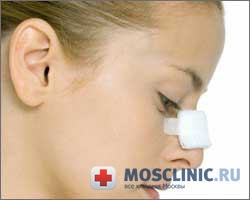 leziuni pentru nas și prim ajutor pentru ei
