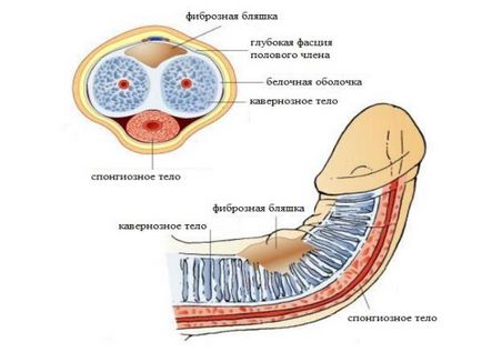 boala Peyronie la barbati cauze, simptome, diagnostic si tratament la domiciliu si chirurgie