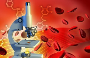 Care este diferența dintre infecțiile cu HIV și SIDA distincție și diferența (diferite) Care este diferența dintre HIV și SIDA infecții distincție și diferența