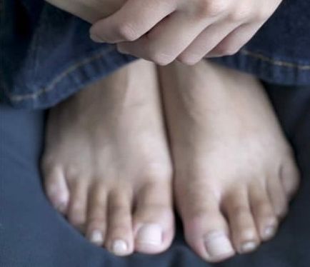 Ce se întâmplă dacă fluxurile de sânge (fluxuri) de la nas Ce se întâmplă dacă sângele care curge din nas