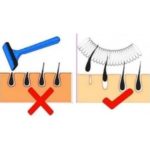 Care este aparatul și modul în care funcționează, diverse tehnici pentru a elimina parul nedorit în salon (păr) Care este aparatul și modul în care funcționează, diverse tehnici pentru a elimina coafor nedorite