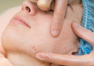 Ce este un exfoliant pentru față și corp, cum funcționează, eficiență